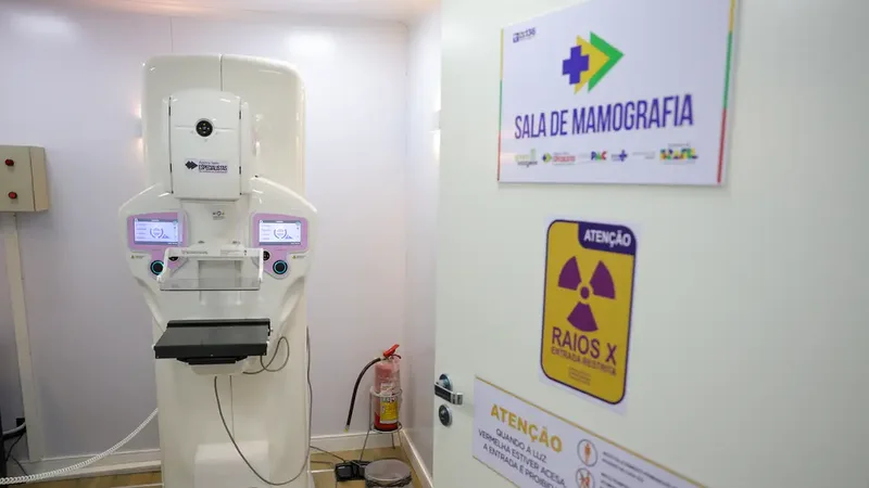 Brasília (DF) 23/10/2025 - Equipamento de mamografia da carreta de saúde da mulher do programa Agora Tem Especialistas no estacionamento do Hospital Regional de Ceilândia, cidade satélite de Brasília