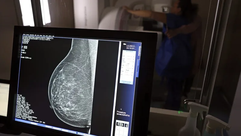 Brasília (DF), 01/10/2024 - Teste de mamografia realizado na Campanha Outubro Rosa: Sesc-DF, que oferece exames e consultas gratuitas às mulheres