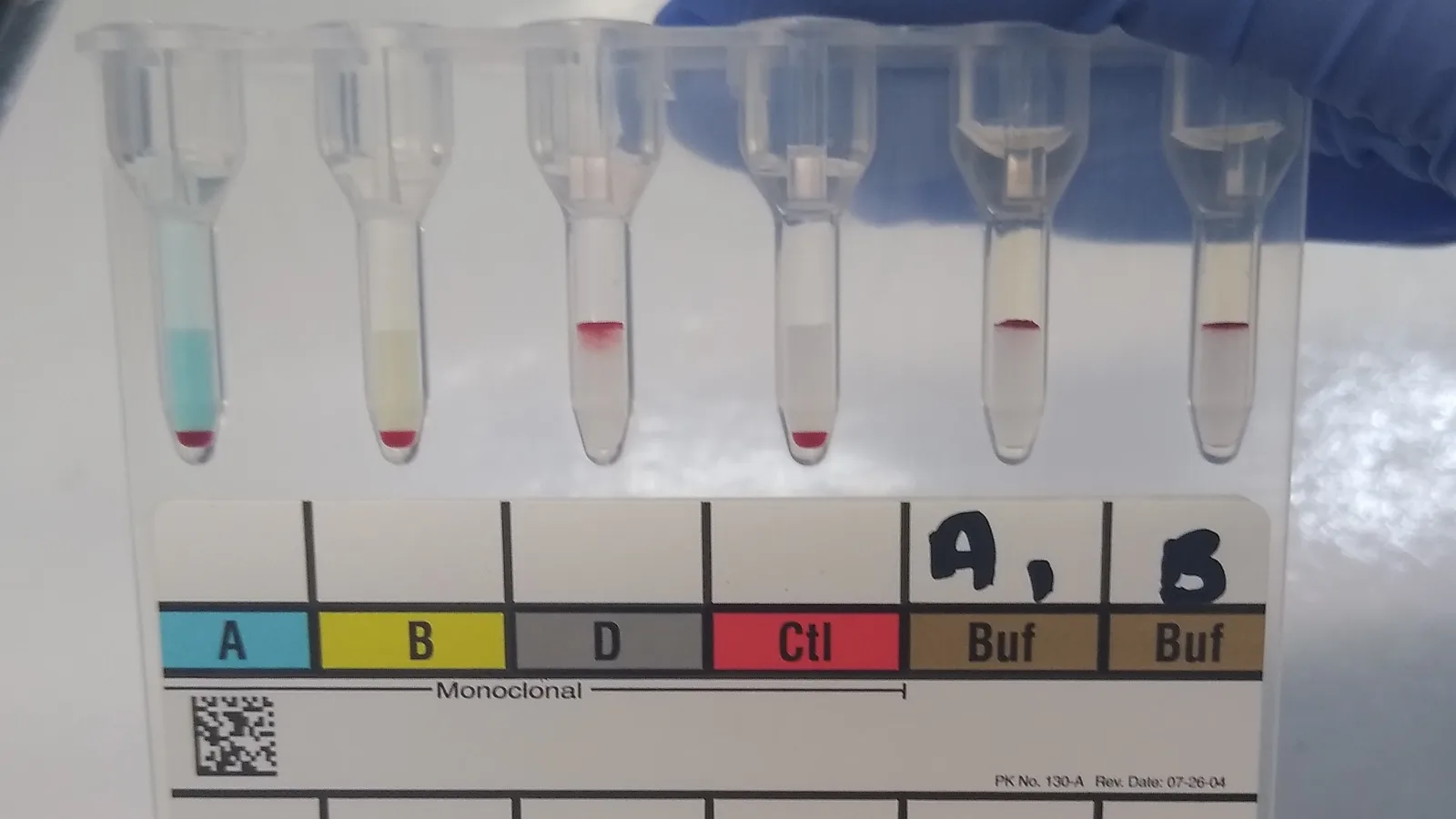 Coleta de sangue para exame laboratorial