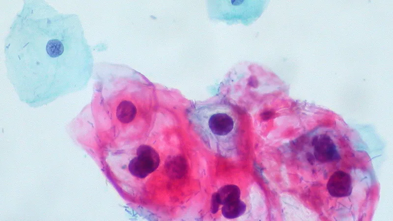 Exame laboratorial de HPV